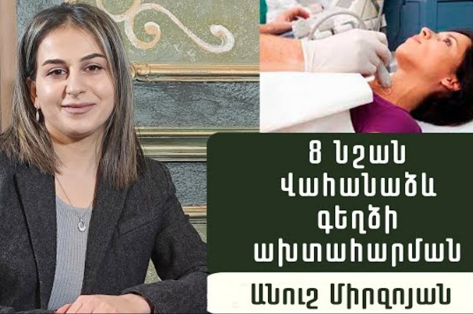 Վահանաձև գեղձի ախտահարման 8 նշան․ էնդոկրինոլոգ Անուշ Միրզոյանը պարզաբանում է բուժման ձևերը (ՎԻԴԵՈ) Վահանաձև գեղձի ախտահարման 8 նշան․ էնդոկրինոլոգ Անուշ Միրզոյանը պարզաբանում է բուժման ձևերը (ՎԻԴԵՈ)