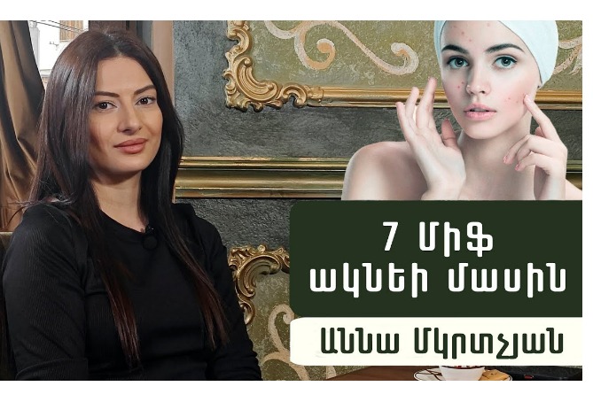 Ինչպե՞ս ազատվել ակնեից․ կոսմետոլոգ Աննա Մկրտչյանը պարզում է իրականությունը (ՎԻԴԵՈ)