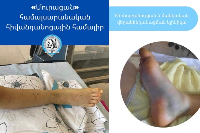 12-летнего мальчика в Армении ужалила гюрза, он был госпитализирован в тяжелом состоянии 12-летнего мальчика в Армении ужалила гюрза, он был госпитализирован в тяжелом состоянии