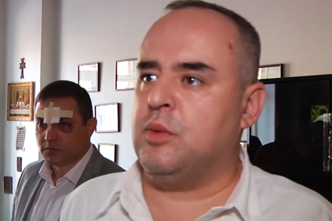 Փաստաբան Աթանեսյանին 50 հազար դոլար են առաջարկել ծեծկռտուքի թեման փակելու համար