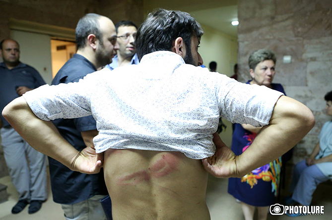 Երևանյան խաղաղ երթից մինչև զանգվածային բախումներ-24
