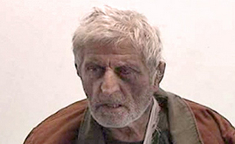 Дело возбуждено по факту нанесения гражданину Армении телесных повреждений в азербайджанском плену