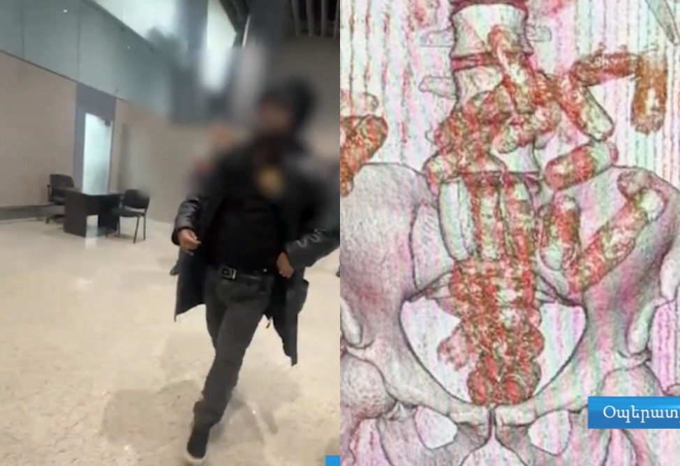 В Армении пресечена попытка контрабанды 845 граммов кокаина (ВИДЕО)