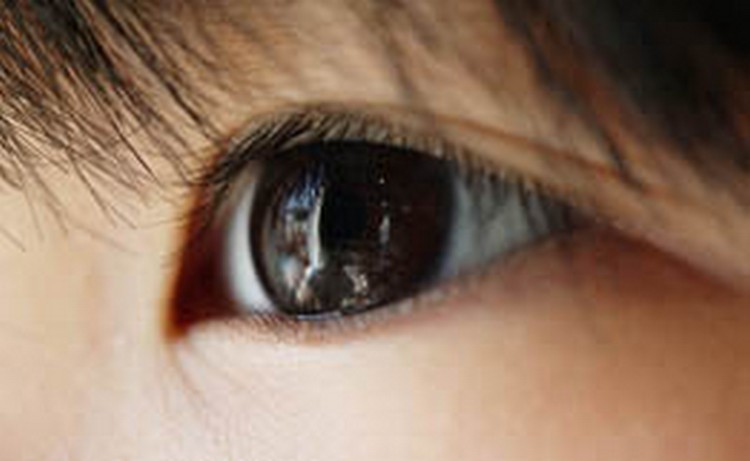 В Великобритании хирурги впервые провели операцию по пересадке искусственного глаза