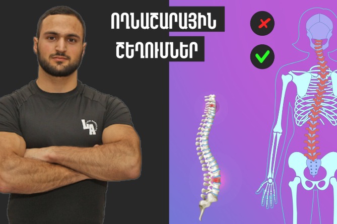 Ողնաշարային շեղումներ, ցավոտ հետևանքներ. տարբերեք միֆը՝ իրականությունից (ՎԻԴԵՈ) Ողնաշարային շեղումներ, ցավոտ հետևանքներ. տարբերեք միֆը՝ իրականությունից (ՎԻԴԵՈ)