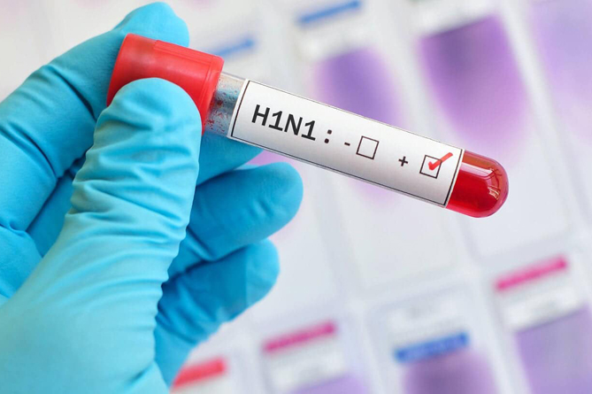 Հայաստանում H1N1 վիրուսով պայմանավորված՝ 2 մահվան դեպք է գրանցվել, պացիենտները 35 տարեկան էին Հայաստանում H1N1 վիրուսով պայմանավորված՝ 2 մահվան դեպք է գրանցվել, պացիենտները 35 տարեկան էին