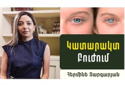 Կատարակտ. ինչպե՞ս վերականգնել աչքի լույսը. ակնաբույժ Հերմինե Զարգարյանի խորհուրդները (ՎԻԴԵՈ)