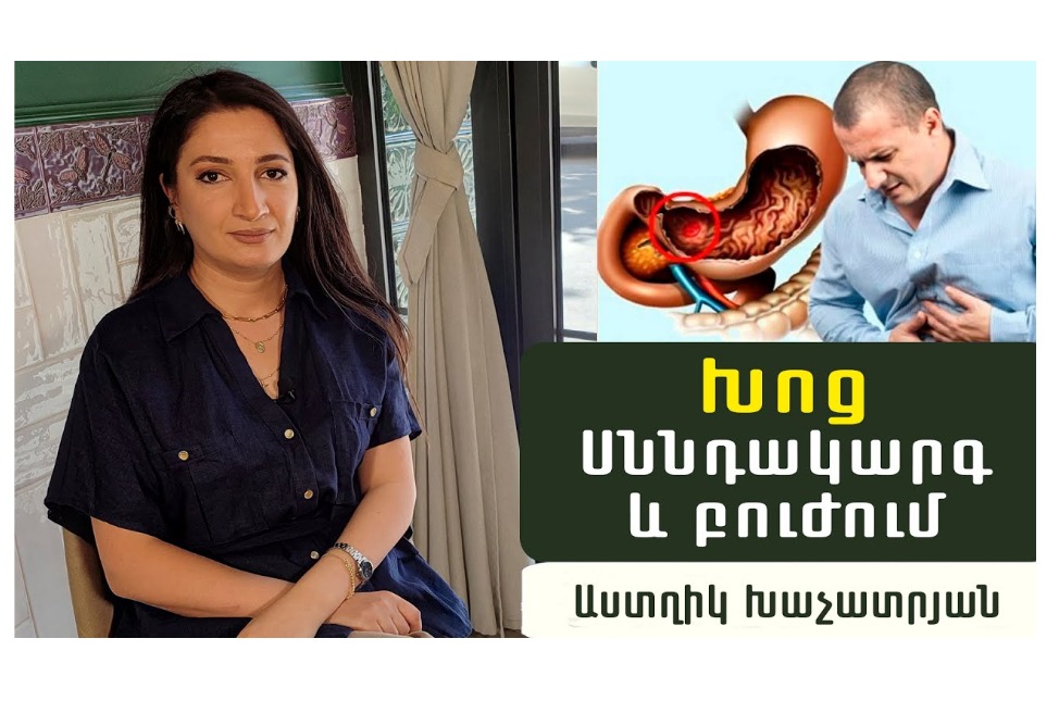 Որո՞նք են ստամոքսի և աղիքի խոցերի առաջացման պատճառները և ո՞ր սնունդն է կանխարգելիչ. պարզաբանում է գաստրոէնտերոլոգ Աստղիկ Խաչատրյանը. (ՎԻԴԵՈ) Որո՞նք են ստամոքսի և աղիքի խոցերի առաջացման պատճառները և ո՞ր սնունդն է կանխարգելիչ. պարզաբանում է գաստրոէնտերոլոգ Աստղիկ Խաչատրյանը. (ՎԻԴԵՈ)