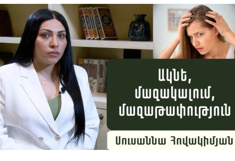 Մաշկային խնդիրներ. ե՞րբ դիմել էնդոկրինոլոգի. էնդոկրինոլոգ,մաշկաբան Սուսաննա Հովակիմյանը պարզաբանում է (ՎԻԴԵՈ) Մաշկային խնդիրներ. ե՞րբ դիմել էնդոկրինոլոգի. էնդոկրինոլոգ,մաշկաբան Սուսաննա Հովակիմյանը պարզաբանում է (ՎԻԴԵՈ)