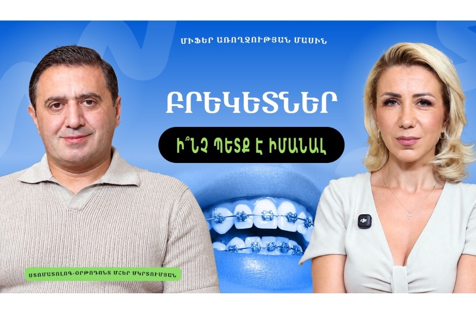 Բրեկետներ. ո՞ր տարիքից սկսել, կարո՞ղ են ատամները նորից ծռվել. պարզաբանում է ստոմատոլոգ-օրթոդոնտ Մհեր Մկրտումյան (ՎԻԴԵՈ)
