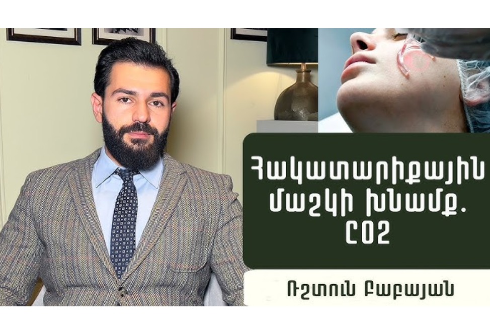 Ինչպե՞ս ունենալ երիտասարդ մաշկ հաշված օրերի ընթացքում. մաշկավեներաբան Ռշտուն Բաբայանը պարզաբանում է (ՎԻԴԵՈ) Ինչպե՞ս ունենալ երիտասարդ մաշկ հաշված օրերի ընթացքում. մաշկավեներաբան Ռշտուն Բաբայանը պարզաբանում է (ՎԻԴԵՈ)